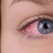 Sonbahar Mevsiminde Kontakt Lens Kullanımı: Dikkat Edilmesi Gerekenler